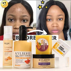 Organic Turmeric Brightening Skincare Kit