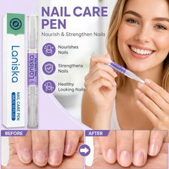 Nail Nutrition Oil Pen Nail Treatment Cuticle Revitalizer Oil Prevent Agnail Nail Polish Soften Nourish Nail Care