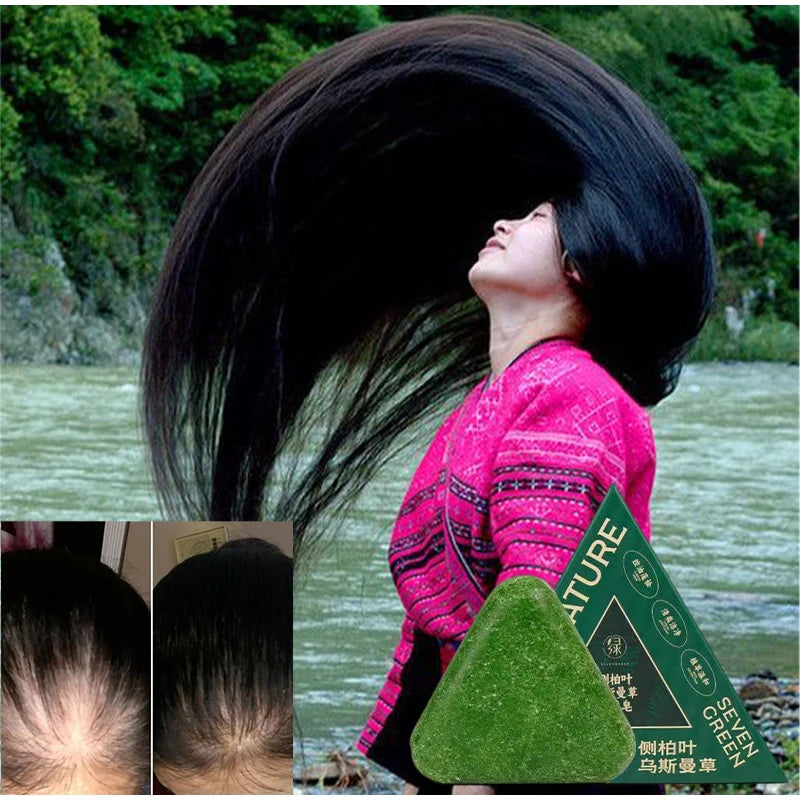 Arborvitae Leaf Shampoo Soap Handmade Natural Herbal Scalp Itching Relief Promote Hair Growth Prevent Hair Loss And DandruffSoap