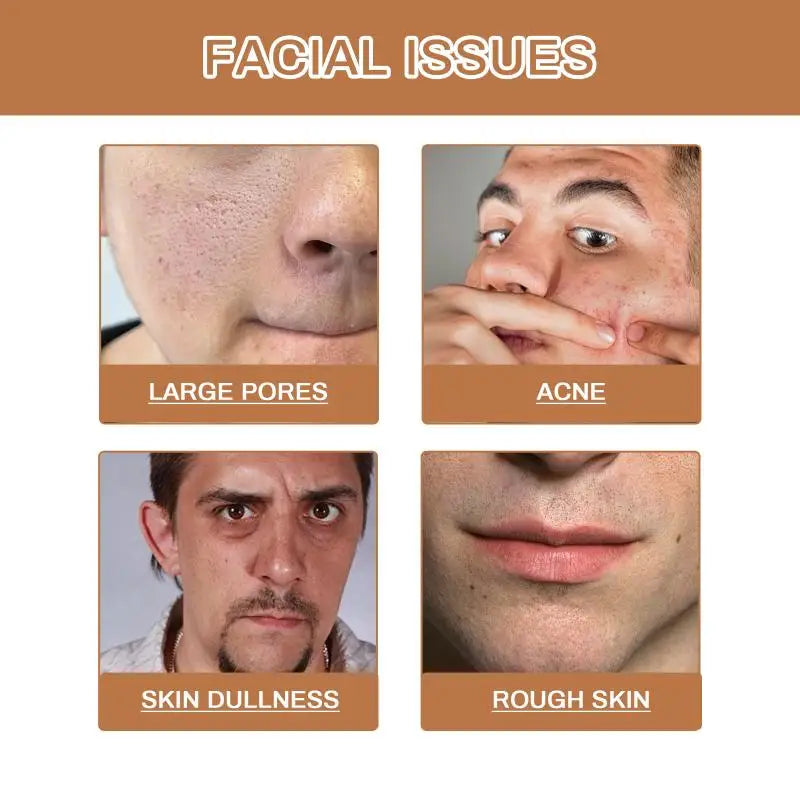 Men Facial Wash Deep Cleansing Oil Control Exfoliating Whitening Moisturizing For Daily Skin Care Dullness Removal