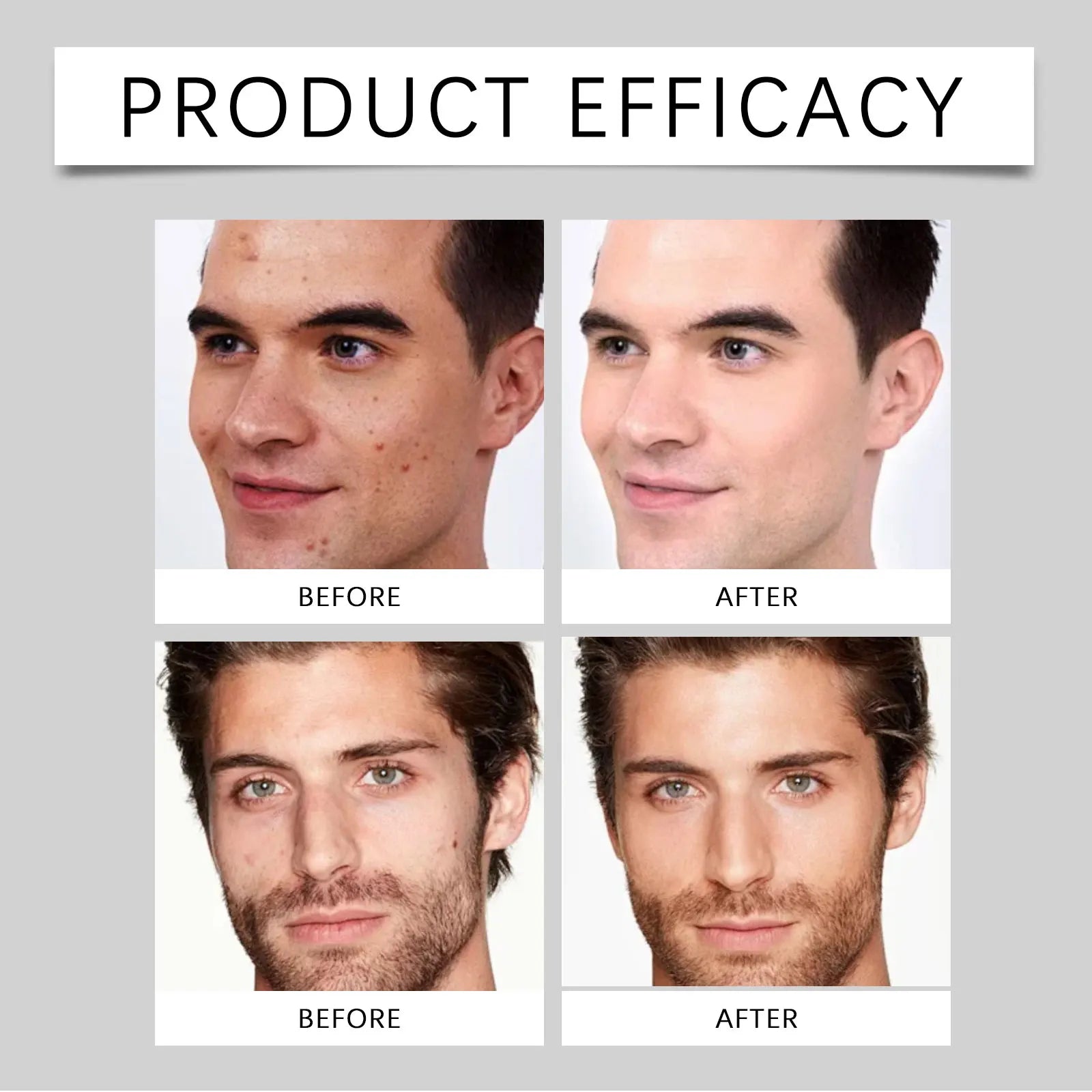 Men's Facial Moisturizer Cream Mild Gentle Formula Smooth Easy To Spread Hydrating Tender Daily Skin Care For Men Face