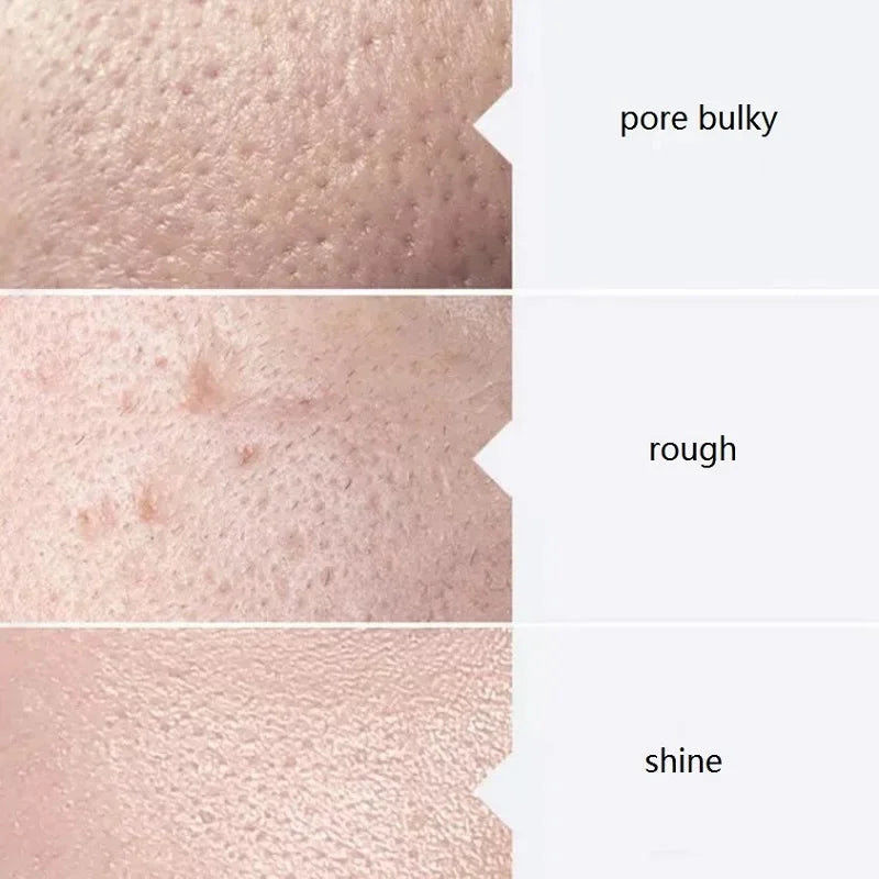 Aqua Peel Facial Serum Trio