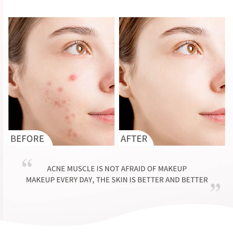 NOVO Moisturizing Lightweight Foundation Make-Up Can Create Natural And Soft Skin With Good Makeup Holding And Blemish Effect,