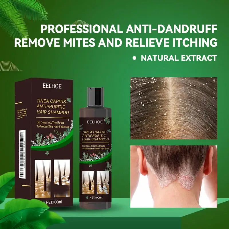 Professional Herbal Hair Shampoo Deep Moisturizing and Nourishing Scalp Care Removes Dandruff Suitable for Daily Use