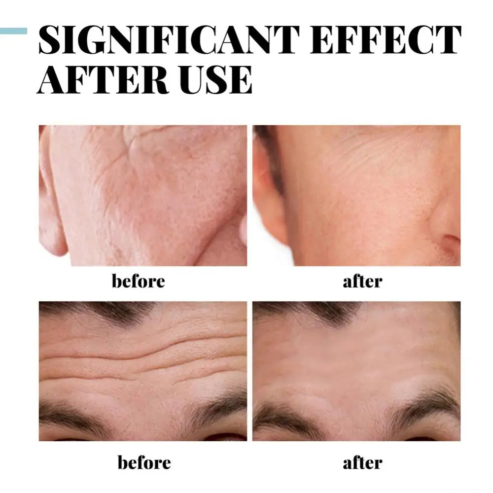 Collagen Creams For Men Improve Skin Quality Face Cream Firming Moisturizing Hyaluronic Acid Cream Facial Skin Care