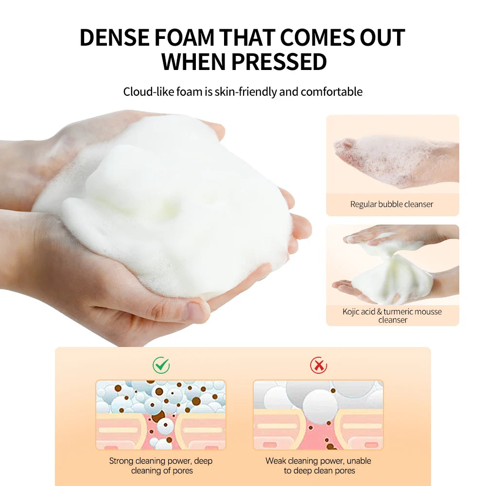 Turmeric Kojic Acid Cleansing Mousse
