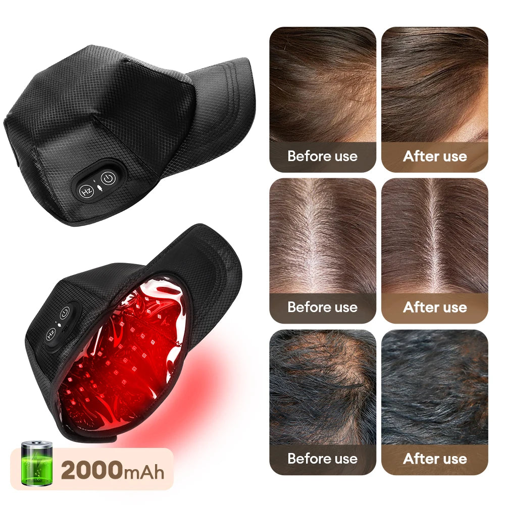 650nm+850nm Infrared Red Light Hair Growth Cap Hair Loss Treatment Hat Anti Hair Loss Restore Hair Thickness Hair Regrowth Care