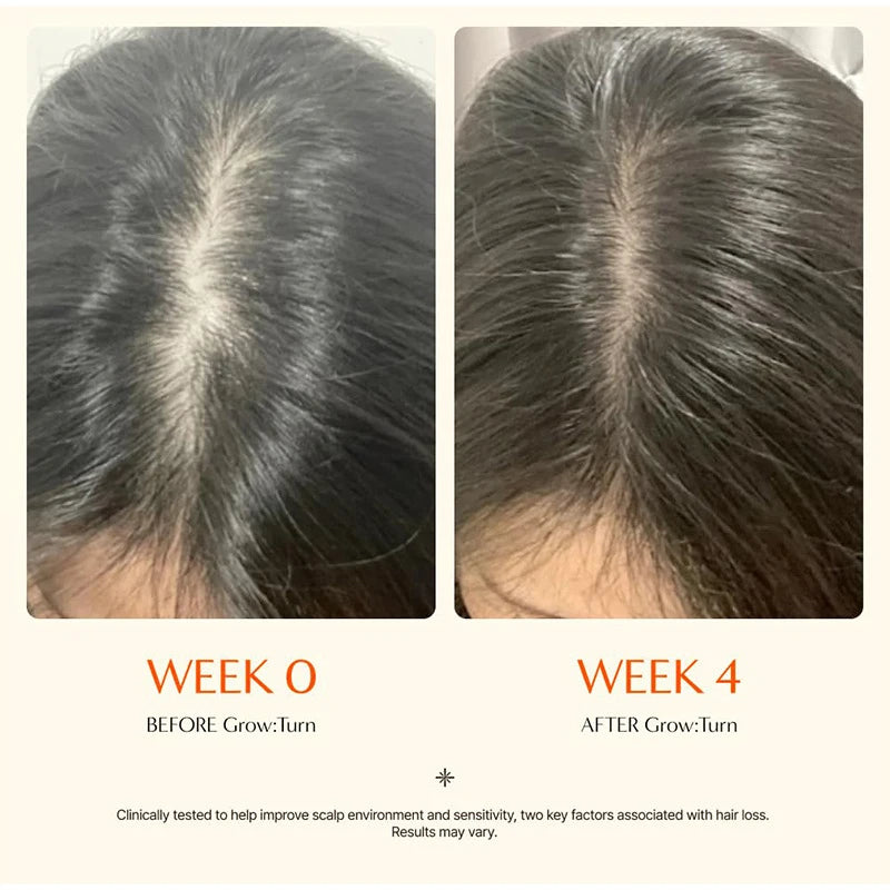 Hair Serum With Built-In Brush,Hair Nourishing Strengthening Essence,Improve Scalp Environment,Scalp Massager,Korean Hair Care