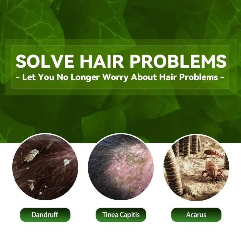 Professional Herbal Hair Shampoo Deep Moisturizing and Nourishing Scalp Care Removes Dandruff Suitable for Daily Use