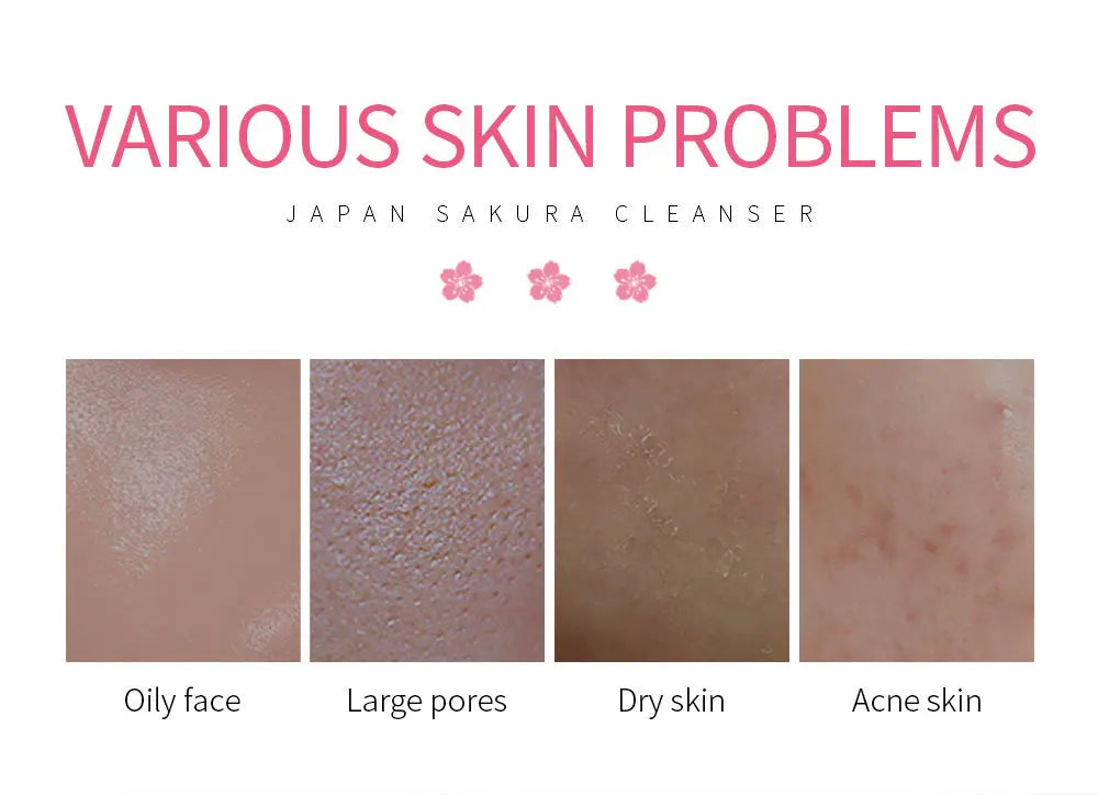 Foaming Oil Control Facial Cleanser
