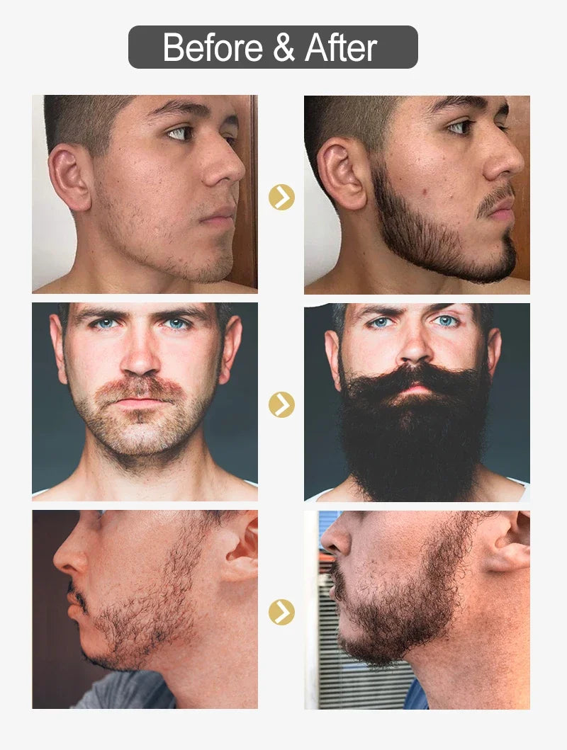 30ml Natural Beard Care Serum for Men, Hydrates Repairs Beard Roots Styling Care Nourishing Soft Shine Beard & Moustache Spray