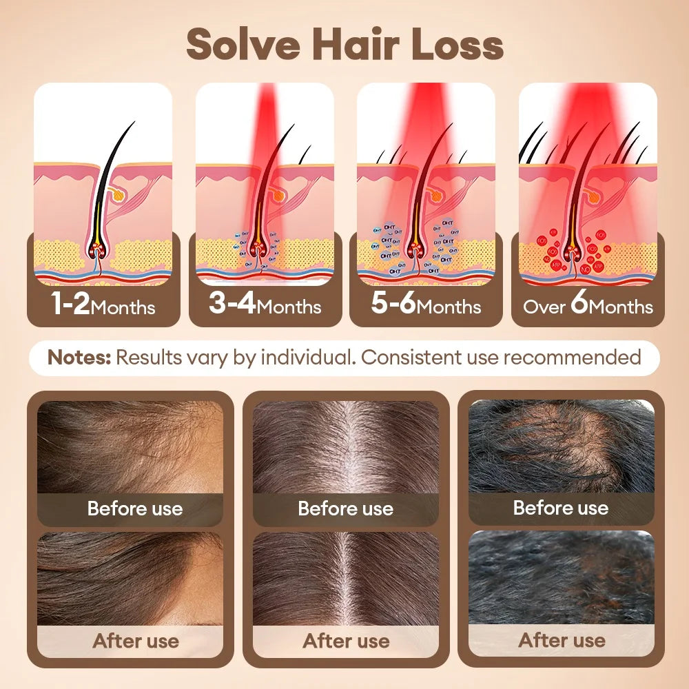 650nm+850nm Infrared Red Light Hair Growth Cap Hair Loss Treatment Hat Anti Hair Loss Restore Hair Thickness Hair Regrowth Care