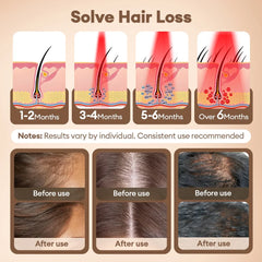 650nm+850nm Infrared Red Light Hair Growth Cap Hair Loss Treatment Hat Anti Hair Loss Restore Hair Thickness Hair Regrowth Care