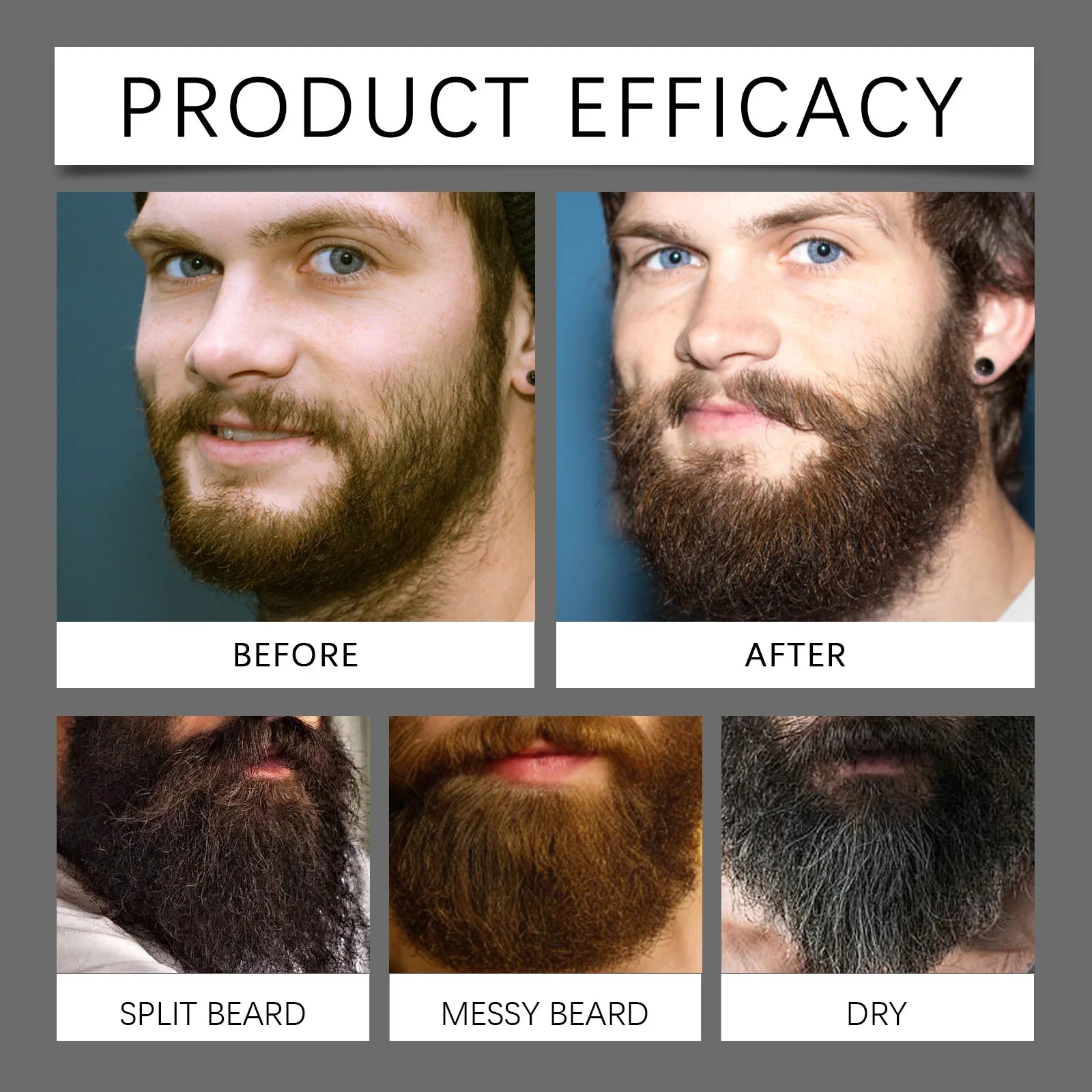 Beard Thickening Care Oil with Roller Ball 0.25mm Strengthen Hair Roots Nourishing Soften Beard Oil for Men Grooming Beard Care