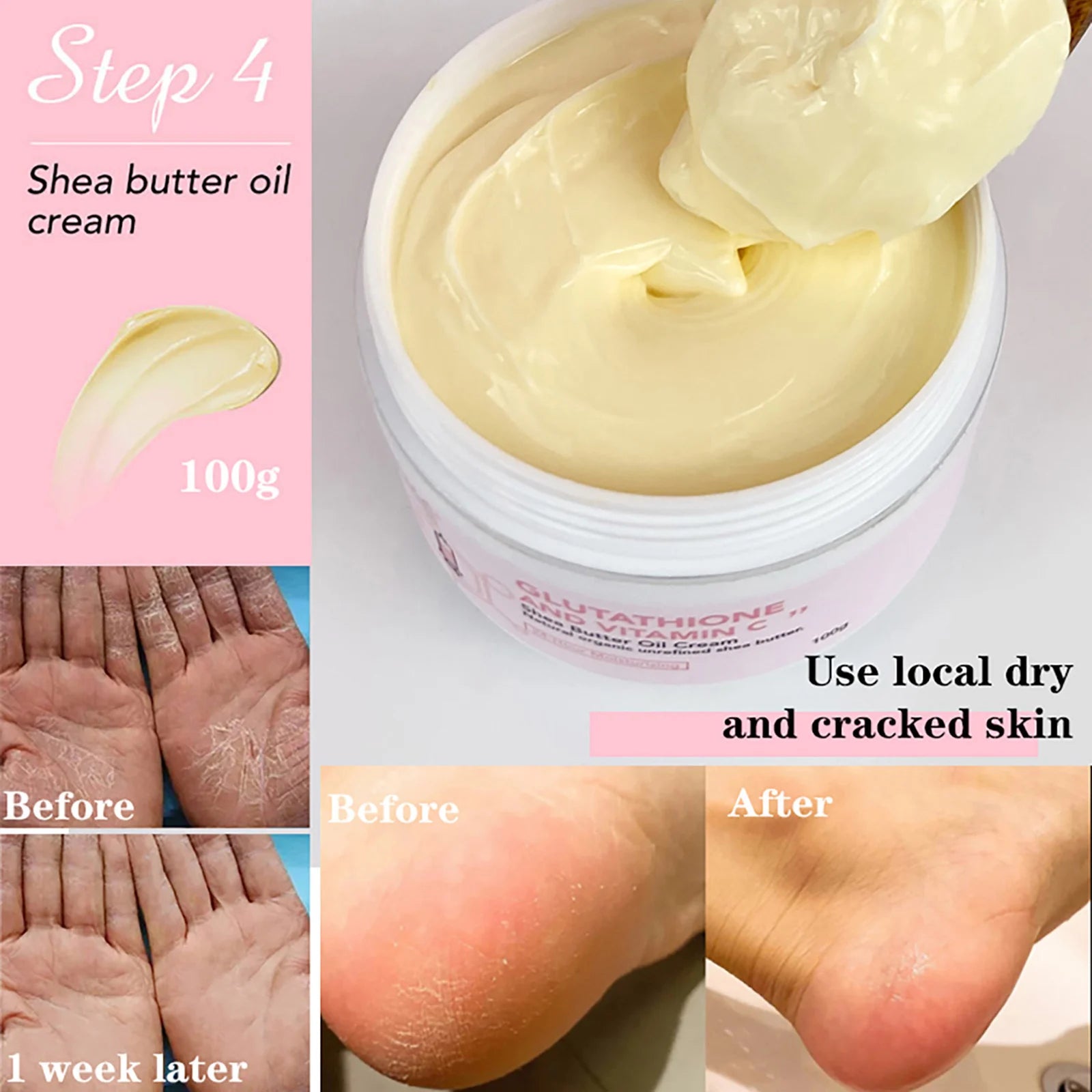 Vitamin C Whitening Moisture Lotion
