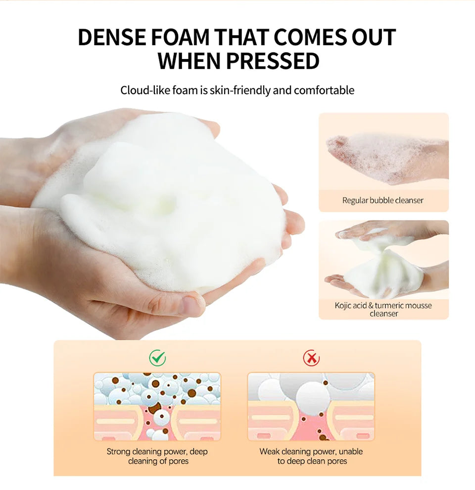 Turmeric Kojic Acid Cleansing Mousse